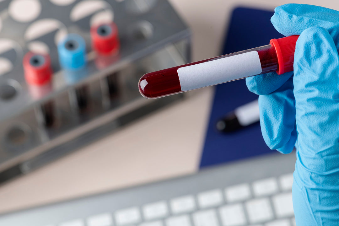 Standard Blood Test
